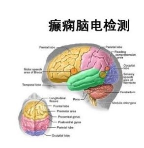 20岁能得癫痫病吗