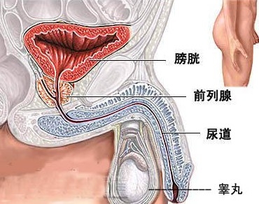 膀胱癌早期怎样治疗比较好?