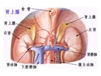 肾上腺嗜铬细胞瘤应该怎么办