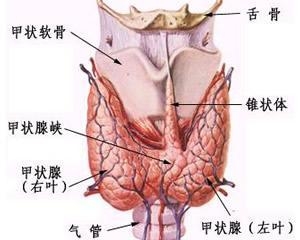 甲状腺癌是怎么引起的